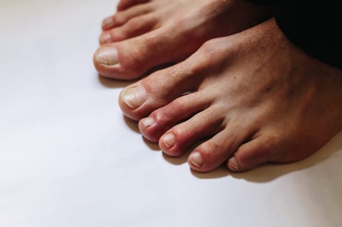 Toes | Photo: Shutterstock